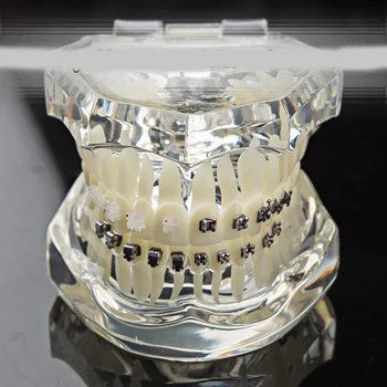 Стоматологичен ортодонтическая модел самолигирующийся скоба от директен тел с ребра, четири вида керамични скоби, сравнителна модел